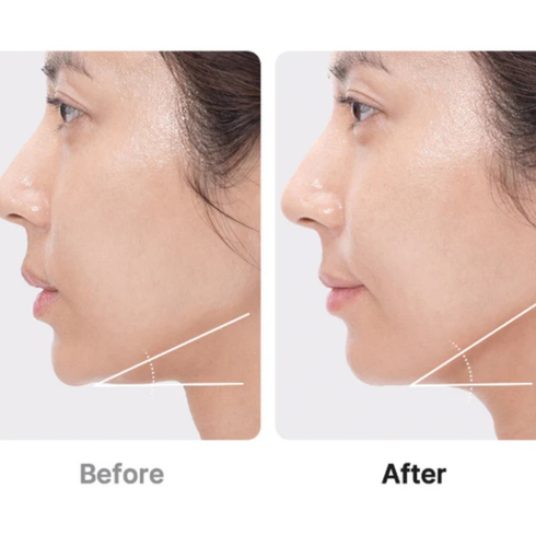 MEDICUBE AGE-R Booster Pro EX | NIASHA.ch