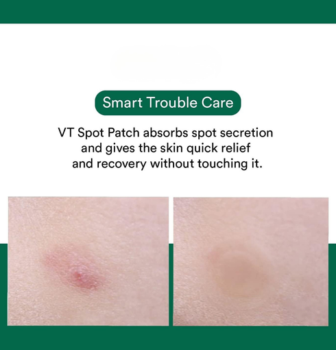 VT COSMETICS VT Spot Patch (48 ea)| NIASHA.ch